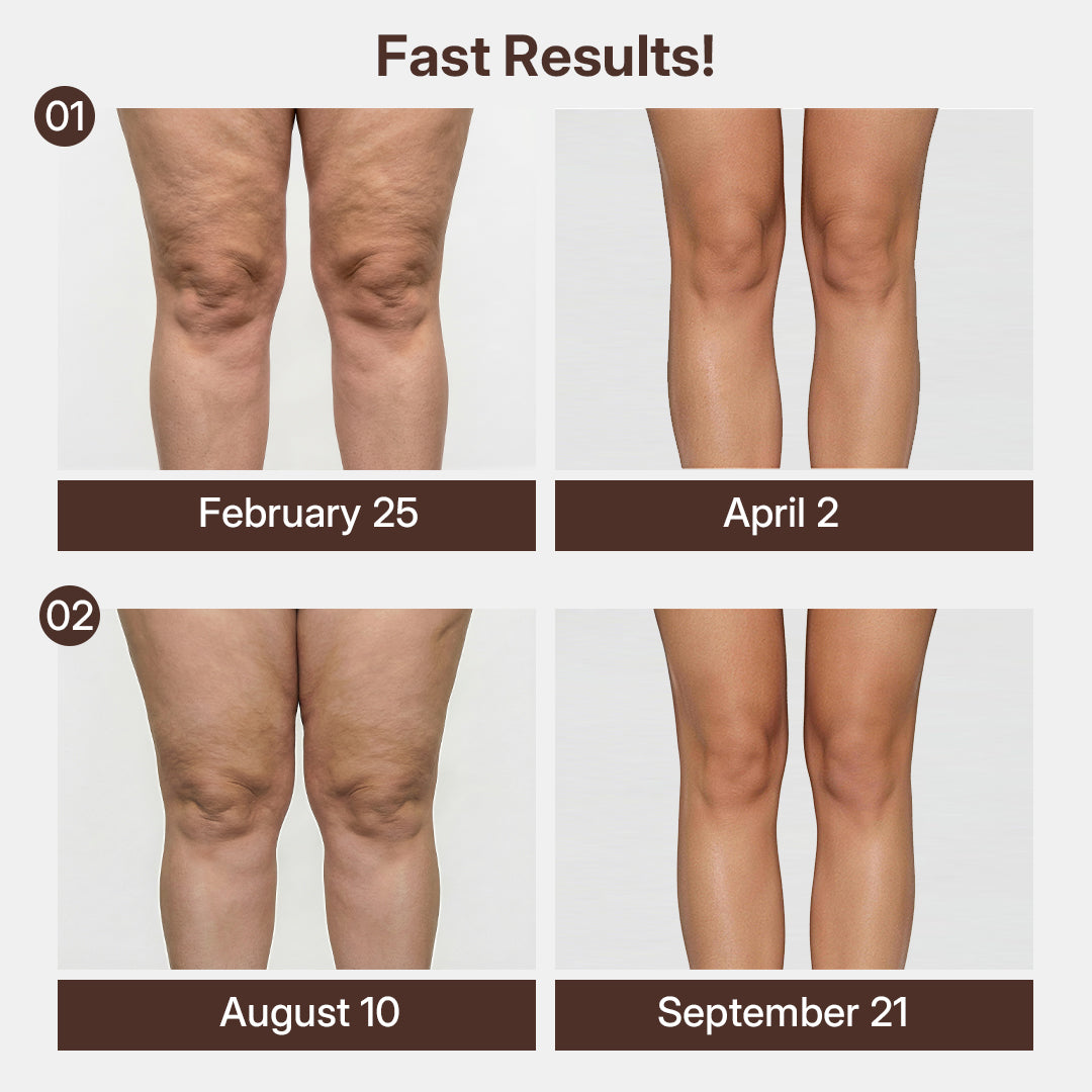 Quinn's™ 3D Compression Knee Sleeves –Say Goodbye to Saggy, Uneven-Looking Legs
