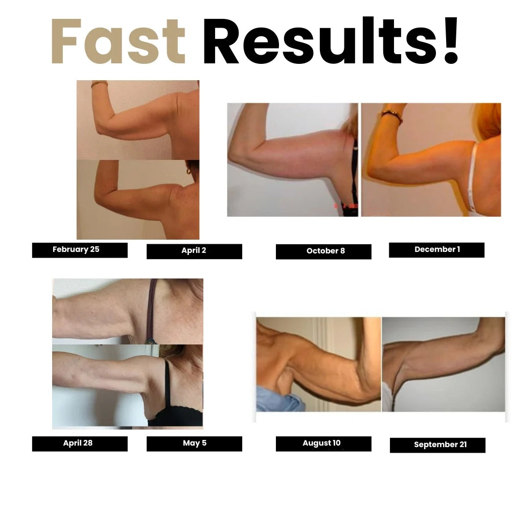 Quinn's™ 3D Compression Sleeves – Say Goodbye to Arm Jiggle